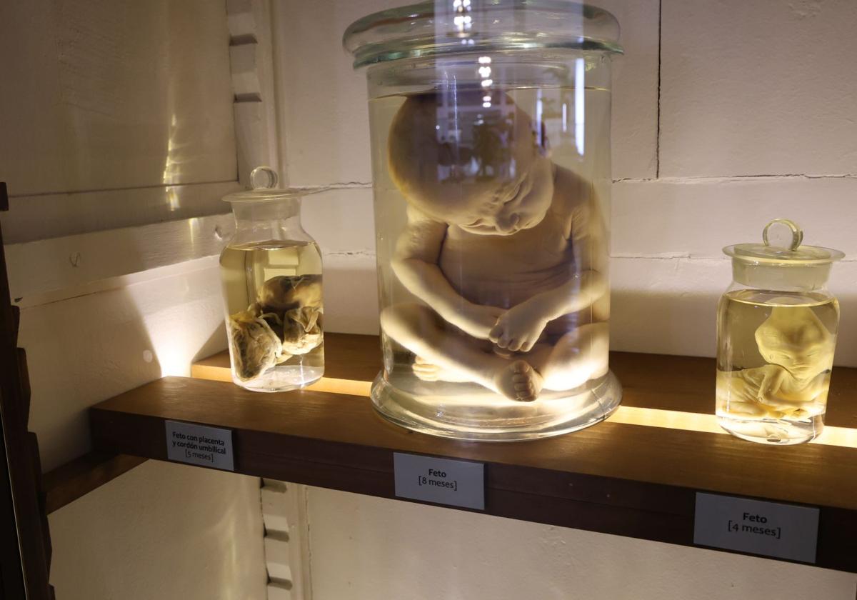La variopinta colección del Museo de Ciencias Naturales de Valladolid